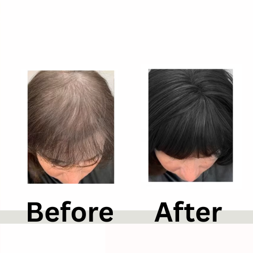 Betty Hair Topper